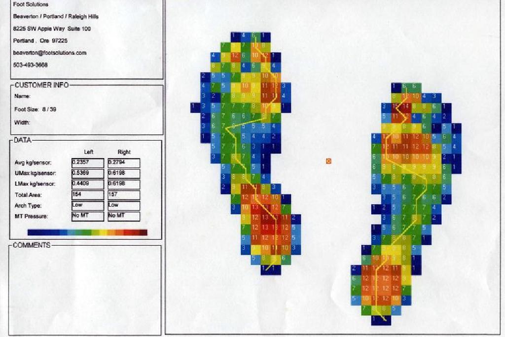 Euthyrox efecte secundare pierdere în greutate | 